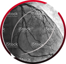 Angiogram