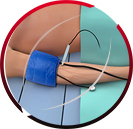 Ankle-Brachial Index