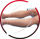 Duplex Ultrasound