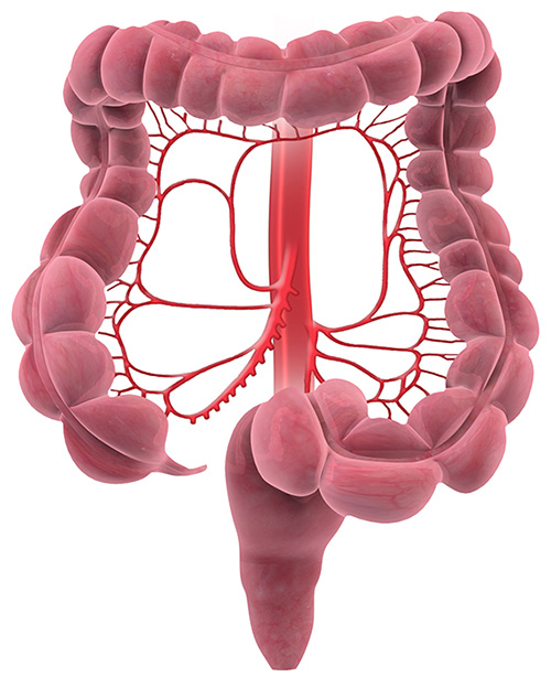 Mesenteric Artery