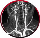 MR Angiogram