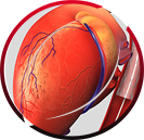 Surgical Aneurysm Repair