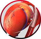 Thoracic Aortic Aneurysm Endovascular Repair